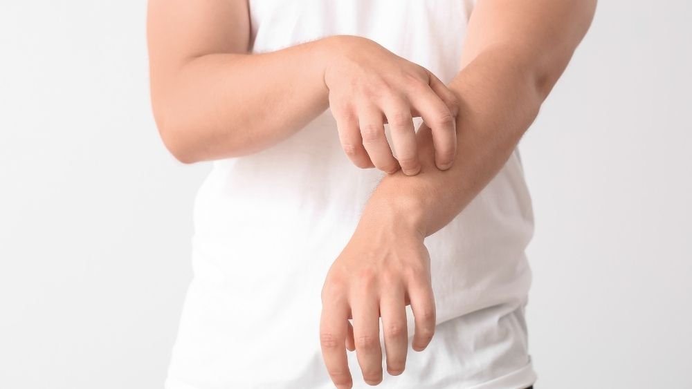 Eczema and Dermatitis Banner